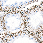 ATF1 Antibody in Immunohistochemistry (Paraffin) (IHC (P))