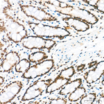 ATF1 Antibody in Immunohistochemistry (Paraffin) (IHC (P))