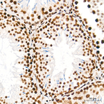 ATF1 Antibody in Immunohistochemistry (Paraffin) (IHC (P))