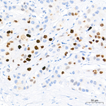 UHRF1 Recombinant Rabbit Monoclonal Antibody (6O5N3)