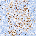 UHRF1 Antibody in Immunohistochemistry (Paraffin) (IHC (P))