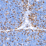 UHRF1 Antibody in Immunohistochemistry (Paraffin) (IHC (P))