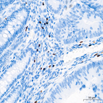 FOXP3 Antibody in Immunohistochemistry (Paraffin) (IHC (P))