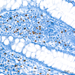 FOXP3 Antibody in Immunohistochemistry (Paraffin) (IHC (P))