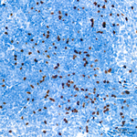 FOXP3 Antibody in Immunohistochemistry (Paraffin) (IHC (P))