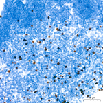 FOXP3 Antibody in Immunohistochemistry (Paraffin) (IHC (P))