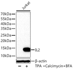 IL-2 Antibody in Western Blot (WB)