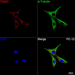 TIMM23 Antibody in Immunocytochemistry (ICC/IF)