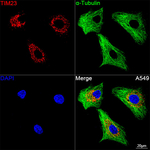 TIMM23 Antibody in Immunocytochemistry (ICC/IF)