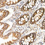 TIMM23 Antibody in Immunohistochemistry (Paraffin) (IHC (P))