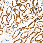 TIMM23 Antibody in Immunohistochemistry (Paraffin) (IHC (P))