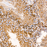 TIMM23 Antibody in Immunohistochemistry (Paraffin) (IHC (P))
