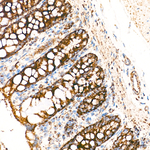 TIMM23 Antibody in Immunohistochemistry (Paraffin) (IHC (P))