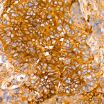 SLC16A3 Antibody in Immunohistochemistry (Paraffin) (IHC (P))