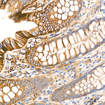 SLC16A3 Antibody in Immunohistochemistry (Paraffin) (IHC (P))