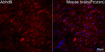 ABHD6 Antibody in Immunohistochemistry (Frozen) (IHC (F))
