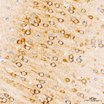 ABHD6 Antibody in Immunohistochemistry (Paraffin) (IHC (P))