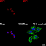 ZBP1 Recombinant Rabbit Monoclonal Antibody (7X7E4)