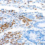 ZBP1 Antibody in Immunohistochemistry (Paraffin) (IHC (P))