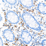 ZBP1 Antibody in Immunohistochemistry (Paraffin) (IHC (P))