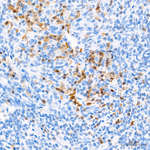 ZBP1 Antibody in Immunohistochemistry (Paraffin) (IHC (P))