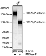 P-Selectin Antibody in Western Blot (WB)