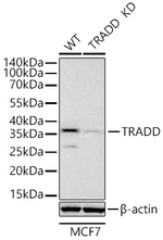 TRADD Antibody in Western Blot (WB)