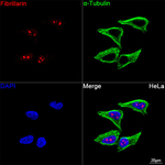 Fibrillarin Antibody in Immunocytochemistry (ICC/IF)