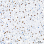 Fibrillarin Antibody in Immunohistochemistry (Paraffin) (IHC (P))