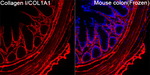 COL1A1 Antibody in Immunohistochemistry (Paraffin) (IHC (P))