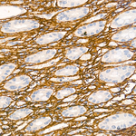 COL1A1 Antibody in Immunohistochemistry (Paraffin) (IHC (P))
