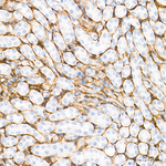 COL1A1 Antibody in Immunohistochemistry (Paraffin) (IHC (P))
