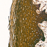 HSP27 Antibody in Immunohistochemistry (Paraffin) (IHC (P))