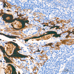 HSP27 Antibody in Immunohistochemistry (Paraffin) (IHC (P))