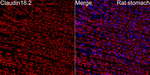 Claudin 18.2 Antibody in Immunohistochemistry (Paraffin) (IHC (P))