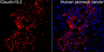 Claudin 18.2 Antibody in Immunohistochemistry (Paraffin) (IHC (P))