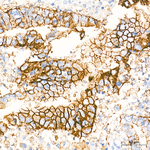 Claudin 18.2 Antibody in Immunohistochemistry (Paraffin) (IHC (P))