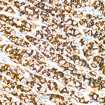 Claudin 18.2 Antibody in Immunohistochemistry (Paraffin) (IHC (P))