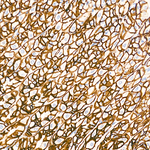Claudin 18.2 Antibody in Immunohistochemistry (Paraffin) (IHC (P))