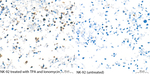 IFN gamma Antibody in Immunohistochemistry (Paraffin) (IHC (P))