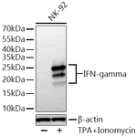 IFN gamma Antibody in Western Blot (WB)