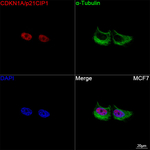 p21 Antibody in Immunocytochemistry (ICC/IF)