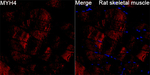 Myosin 4 Recombinant Rabbit Monoclonal Antibody (9J10C9)