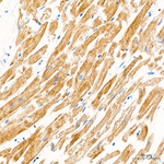 Myosin 4 Antibody in Immunohistochemistry (Paraffin) (IHC (P))