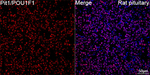 PIT1 Antibody in Immunohistochemistry (Paraffin) (IHC (P))
