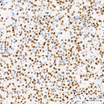 PIT1 Antibody in Immunohistochemistry (Paraffin) (IHC (P))