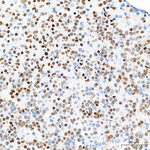 PIT1 Antibody in Immunohistochemistry (Paraffin) (IHC (P))