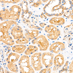 ATF6 Antibody in Immunohistochemistry (Paraffin) (IHC (P))