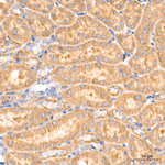 ATF6 Recombinant Rabbit Monoclonal Antibody (2A8J8)