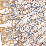 ATF6 Antibody in Immunohistochemistry (Paraffin) (IHC (P))